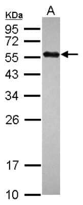 Western Blot: UBR7 Antibody [NBP2-20794]