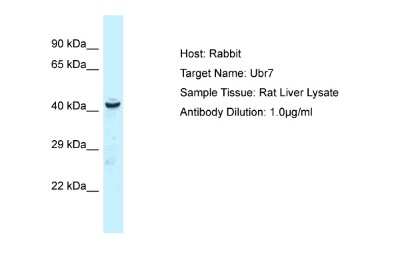 Western Blot: UBR7 Antibody [NBP2-88541]