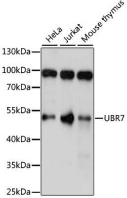 Western Blot: UBR7 AntibodyAzide and BSA Free [NBP2-94818]