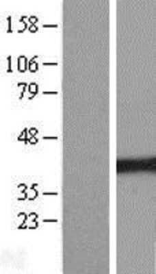 Western Blot: UBR7 Overexpression Lysate [NBP2-06871]