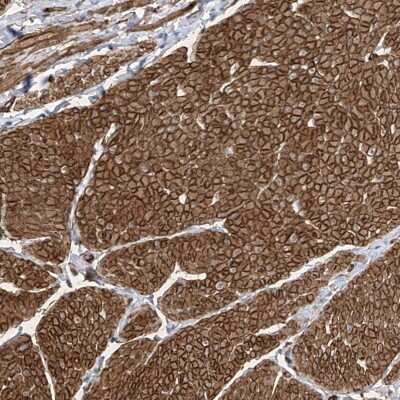 Immunohistochemistry-Paraffin: UBTD1 Antibody [NBP1-82311]