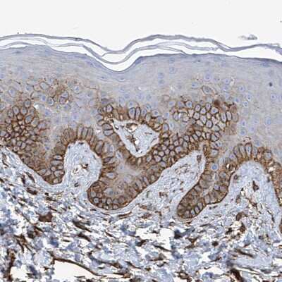 Immunohistochemistry-Paraffin: UBTD1 Antibody [NBP1-82311]
