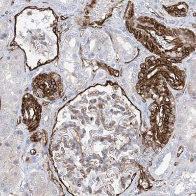 Immunohistochemistry-Paraffin: UBTD1 Antibody [NBP1-82311]