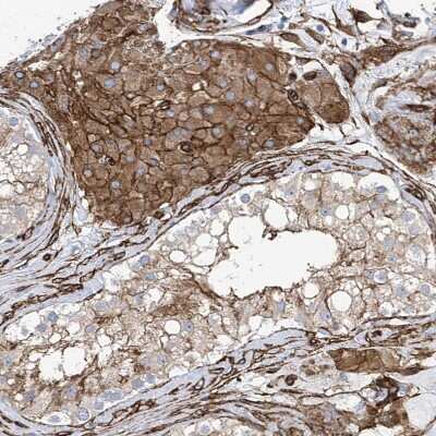 Immunohistochemistry-Paraffin: UBTD1 Antibody [NBP1-82311]