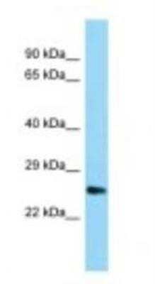 Western Blot: UBTD1 Antibody [NBP1-98480]