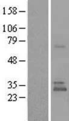 Western Blot: UBTD1 Overexpression Lysate [NBL1-17569]