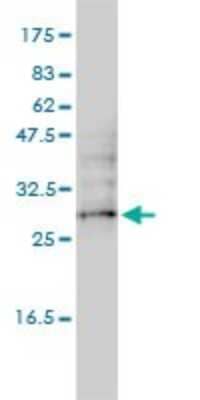 Western Blot: UBTD2 Antibody (1B8-1B1) [H00092181-M01]