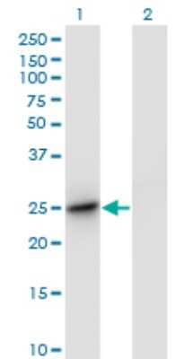 Western Blot: UBTD2 Antibody (1B8-1B1) [H00092181-M01]
