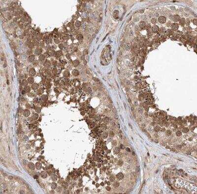 Immunohistochemistry-Paraffin: UBTD2 Antibody [NBP1-85276]