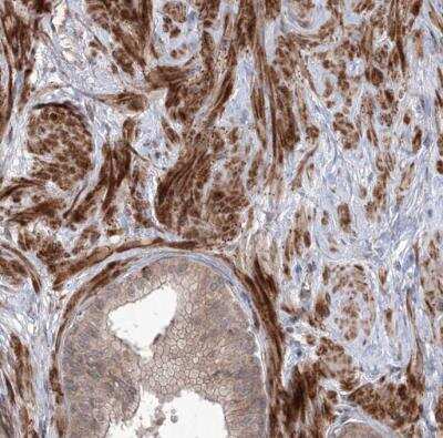Immunohistochemistry-Paraffin: UBTD2 Antibody [NBP1-85276]