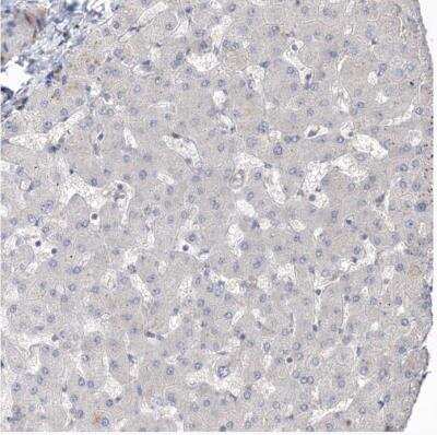 Immunohistochemistry-Paraffin: UBTD2 Antibody [NBP1-85276]