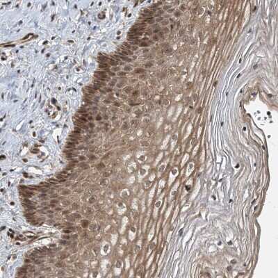 Immunohistochemistry-Paraffin: UBTD2 Antibody [NBP2-38270]