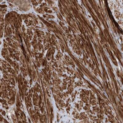Immunohistochemistry-Paraffin: UBTD2 Antibody [NBP2-38270]