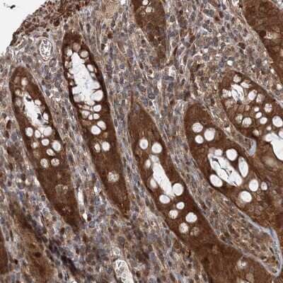 Immunohistochemistry-Paraffin: UBTD2 Antibody [NBP2-38270]