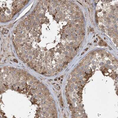 Immunohistochemistry-Paraffin: UBTD2 Antibody [NBP2-38270]
