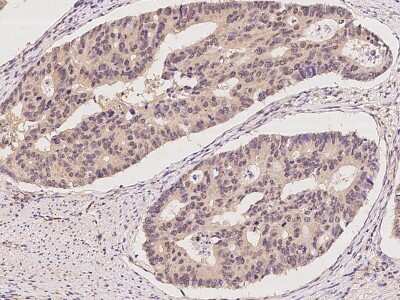 Immunohistochemistry-Paraffin: UBTD2 Antibody [NBP2-98563]