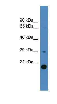 Western Blot: UBTD2 Antibody [NBP1-79759]