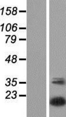 Western Blot: UBTD2 Overexpression Lysate [NBP2-05416]