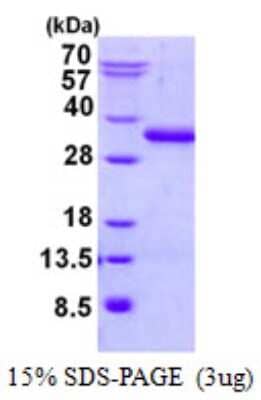 SDS-PAGE: Recombinant Human UBTD2 His Protein [NBP2-22919]