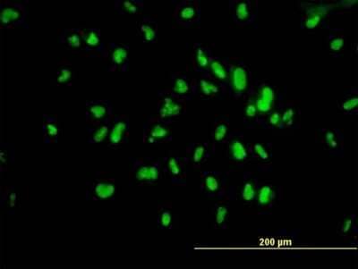 Immunocytochemistry/ Immunofluorescence: UBTF Antibody (1A2) [H00007343-M03]