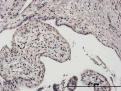 Immunohistochemistry-Paraffin: UBTF Antibody (1A2) [H00007343-M03]
