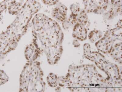 Immunohistochemistry-Paraffin: UBTF Antibody (2D8) [H00007343-M04]