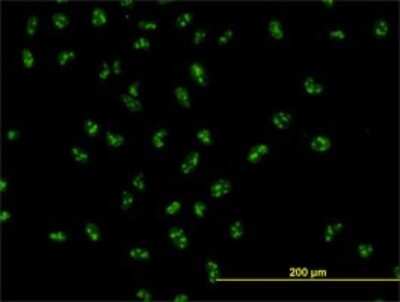 Immunocytochemistry/ Immunofluorescence: UBTF Antibody (6B6) [H00007343-M01]