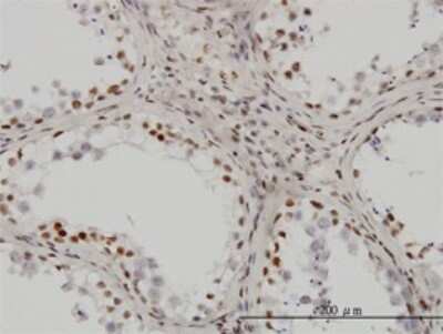 Immunohistochemistry-Paraffin: UBTF Antibody (6B6) [H00007343-M01]