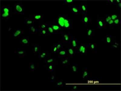 Immunocytochemistry/ Immunofluorescence: UBTF Antibody (6C6) [H00007343-M02]