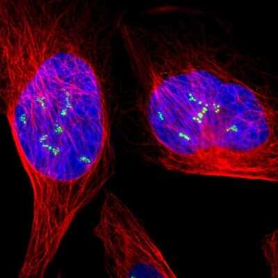 Immunocytochemistry/ Immunofluorescence: UBTF Antibody [NBP1-82545]