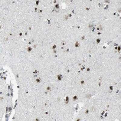 Immunohistochemistry-Paraffin: UBTF Antibody [NBP1-82545]