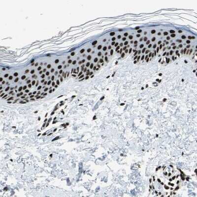 Immunohistochemistry-Paraffin: UBTF Antibody [NBP1-82545]