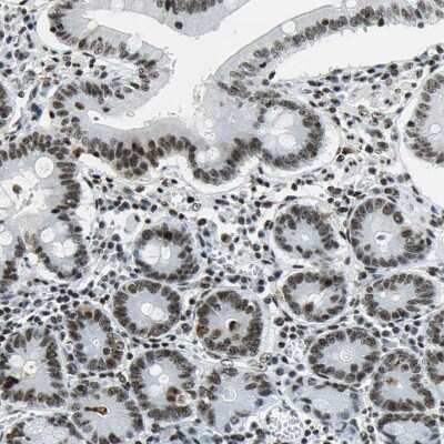 Immunohistochemistry-Paraffin: UBTF Antibody [NBP1-82545]