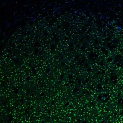 Immunohistochemistry: UBTF Antibody [NBP1-82545]