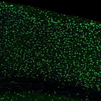 Immunohistochemistry: UBTF Antibody [NBP1-82545]