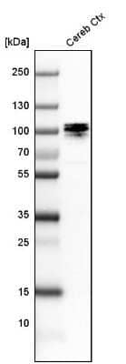 Western Blot: UBTF Antibody [NBP1-82545]