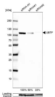 Western Blot: UBTF Antibody [NBP1-82545]