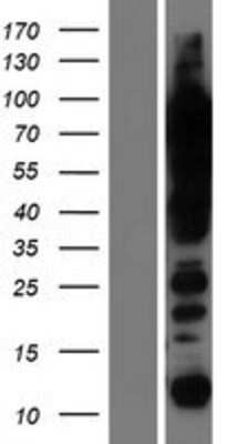 Western Blot: UBTF Overexpression Lysate [NBP2-08444]