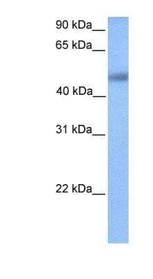 Western Blot: UBTFL1 Antibody [NBP1-91405]