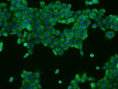 Immunocytochemistry/ Immunofluorescence: UBXD2 Antibody [NBP3-05991]