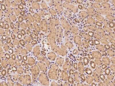 Immunohistochemistry: UBXD2 Antibody [NBP3-05991]