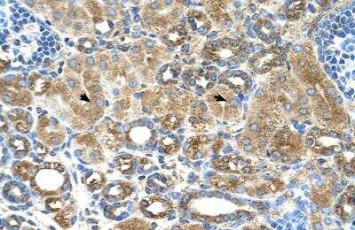 Immunohistochemistry-Paraffin: UBXD2 Antibody [NBP1-79240]