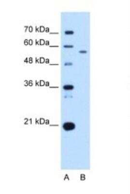 Western Blot: UBXD2 Antibody [NBP1-79240]