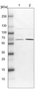 Western Blot: UBXD2 Antibody [NBP1-92560]