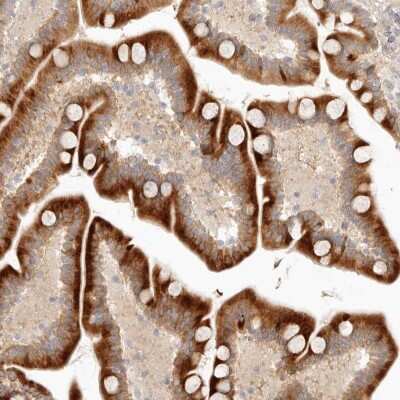 Immunohistochemistry-Paraffin: UBXD5 Antibody [NBP1-87018]