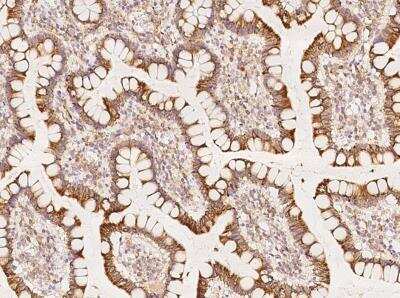 Immunohistochemistry-Paraffin: UBXD5 Antibody [NBP3-05951]