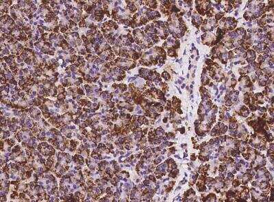 Immunohistochemistry-Paraffin: UBXD5 Antibody [NBP3-05951]