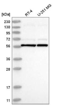 Western Blot: UBXD5 Antibody [NBP2-58719]