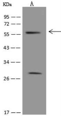 Western Blot: UBXD5 Antibody [NBP3-05951]