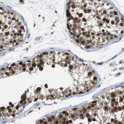 Immunohistochemistry-Paraffin: UBXN1 Antibody [NBP1-89387]